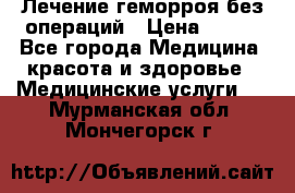 Лечение геморроя без операций › Цена ­ 300 - Все города Медицина, красота и здоровье » Медицинские услуги   . Мурманская обл.,Мончегорск г.